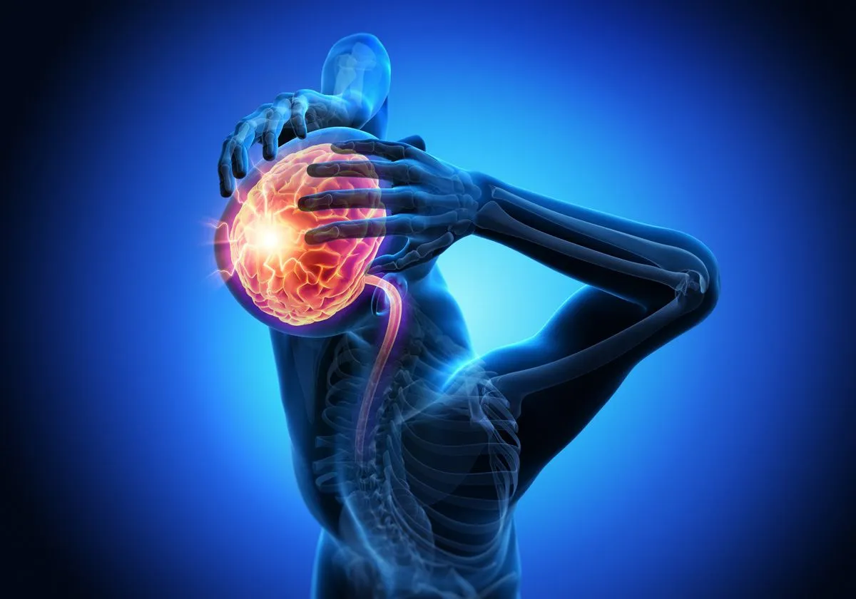 بهترین پزشک درمان میگرن